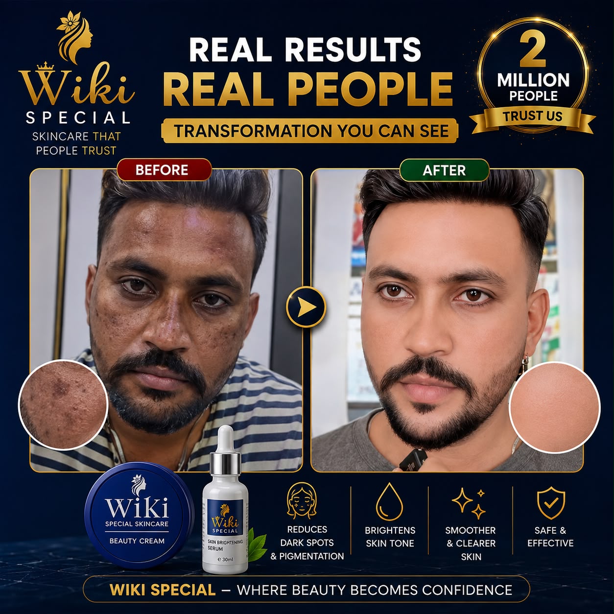 Buy Wiki Beauty Cream & Get Wiki Serum Free