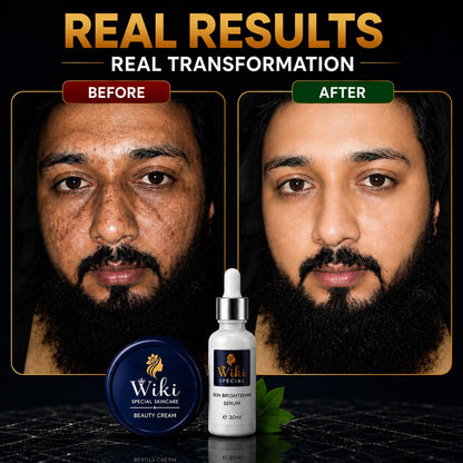 Buy Wiki Beauty Cream & Get Wiki Serum Free